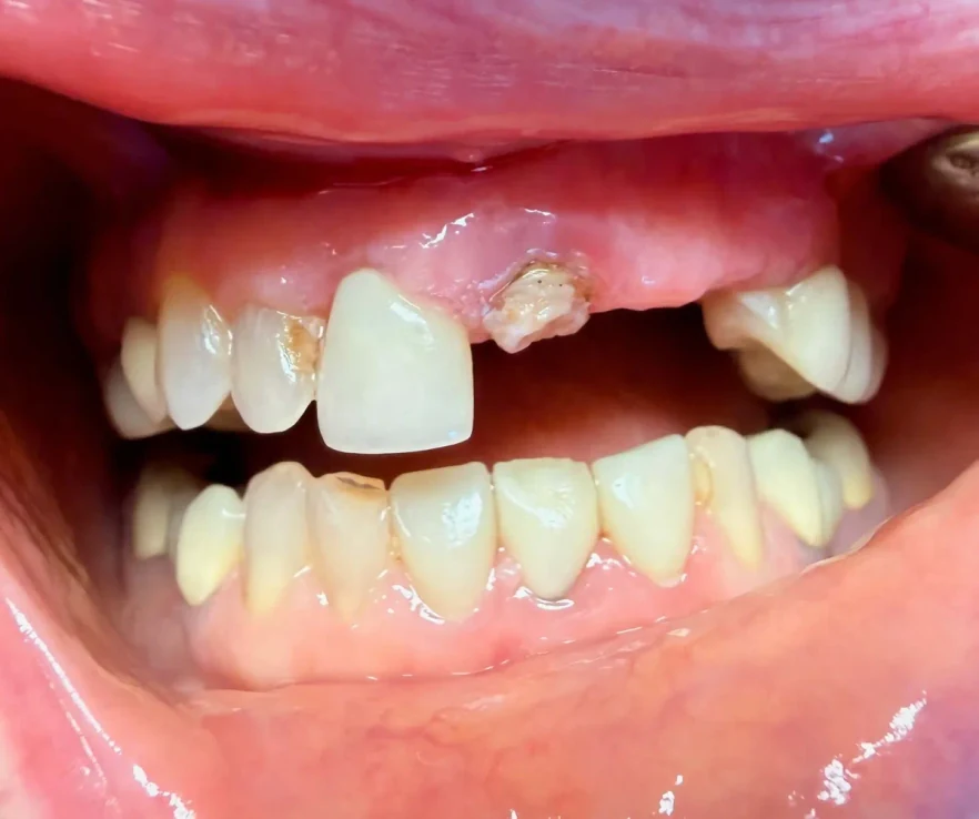 Before photo of a patient's smile